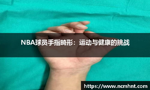 NBA球员手指畸形：运动与健康的挑战